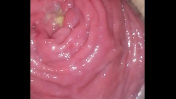 Preview 2 of Ebony Nerd Un Glasses - Anal prolapse
