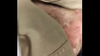 Preview 2 of Campaning - Warts hpv cock in the office