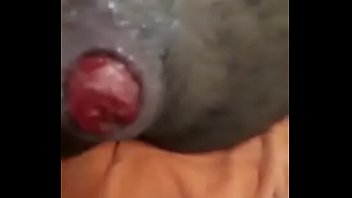 Preview 1 of X Video B 7 - FISTING - Levando m&atilde_o no rabo
