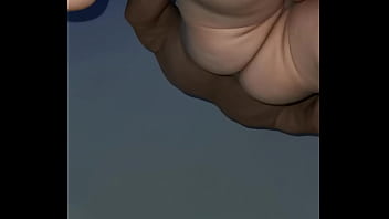 Preview 4 of Pob Xxx Bido - ODNTOLOGO DE 52