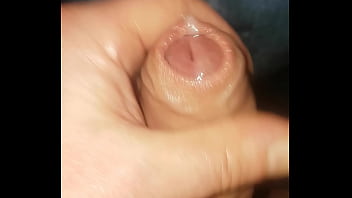 Preview 2 of Anal Prolapse And Squirt