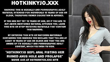 Preview 1 of Jizz Mom Sexy - Hotkinkyjo sefl anal fisting her ruined anus hole and prolapse