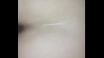 Preview 2 of Hairy Fake Hospital - Chilenita