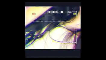 Preview 4 of Patient Nurse Visit Hours - Hot s. Trans