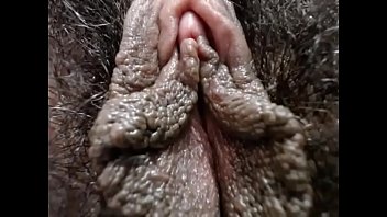 Preview 1 of Xxx Di Hospital - Big hairy pussy