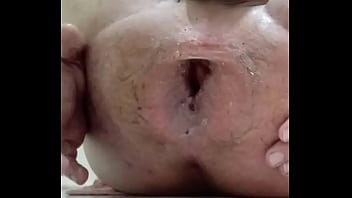 Preview 2 of German Extreme Medical Femdom - uma manga quem n&atilde_o gosta...