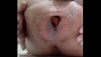 Preview 3 of German Extreme Medical Femdom - uma manga quem n&atilde_o gosta...