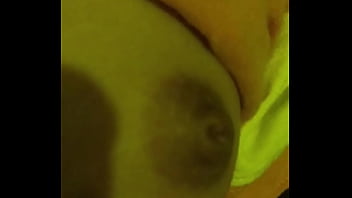 Preview 3 of Circumcision Operation - E nứng lồn qu&aacute_ c&oacute_ ai đụ e ko