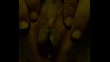 Preview 4 of Circumcision Operation - E nứng lồn qu&aacute_ c&oacute_ ai đụ e ko