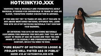 Preview 1 of Fast Pussy Rub Until Cum - Pure beauty of Hotkinkyjo loose &amp_ prolapse well fisted ass in public