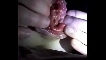 Preview 2 of School Fuck Leak - Anal prolapse