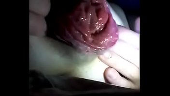 Preview 1 of School Fuck Leak - Anal prolapse