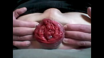 Preview 3 of Mom And Don In Hotel - Anal prolapse