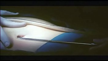 Preview 1 of Wwwsexvido Old Man10 - 香港经典三级片《整容》 翁虹影片
