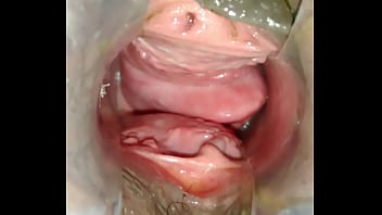 Preview 2 of C Male Fuked Video - Buceta arrombada do jeito que gosto. Prolapso vaginal
