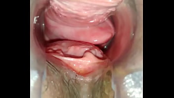 Preview 1 of C Male Fuked Video - Buceta arrombada do jeito que gosto. Prolapso vaginal