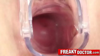 Preview 3 of Wwwwindia Sex - Czech redhead Samantha fetish clinic pussy exam