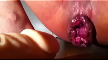 Preview 4 of Horse And Garl Bfxxx - My Anal Dildo Prolapse Orgasmic Fun