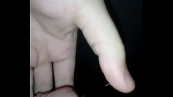 Preview 4 of Teluguboobs - How my dick looks like after circumcision