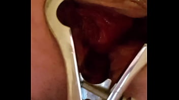Preview 2 of Wwxxuxxcom View - Ass play