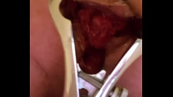 Preview 3 of Wwxxuxxcom View - Ass play