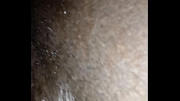 Preview 2 of Wwwpakhdcom Kgn - Ebony made me feel great after the surgery