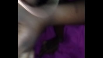 Preview 4 of Wwwpakhdcom Kgn - Ebony made me feel great after the surgery