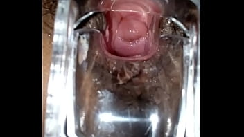 Preview 2 of Czech Elvira - SLIM INDIAN BROWN GIRL CERVIX SPECULUM CHECK VAGINAL OPENING