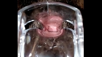 Preview 3 of Czech Elvira - SLIM INDIAN BROWN GIRL CERVIX SPECULUM CHECK VAGINAL OPENING