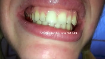 Preview 1 of Www Redwap Me Com - Alicia Gummy Bears Video1
