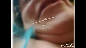 Preview 1 of India Doctor Girl Sexy - Korna