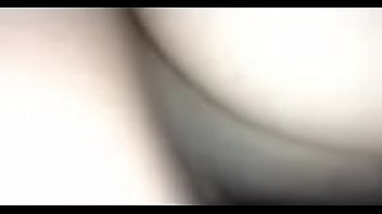Preview 2 of Buttholes Prolapse - IMG 6949