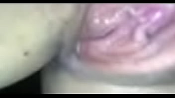 Preview 1 of Buttholes Prolapse - IMG 6949
