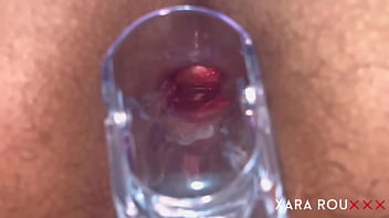 Preview 2 of Hot Setp Son - Anal Vision Speculum