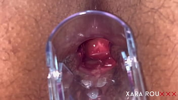 Preview 4 of Hot Setp Son - Anal Vision Speculum