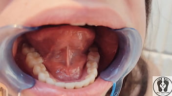 Preview 4 of Wam Lesbian - 4K DENTAL HYGIENIST ROUTINE MOUTH FETISH CLOSEUPS NAKED