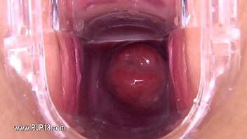 Preview 4 of Cute Accident - Gyno toy inside of her lovely vagina