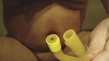 Preview 1 of Chocolati Girls Xxx Vedios - Foley catheter CH 20 - insertion and play.AVI