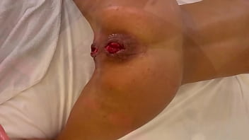 Preview 4 of Amber Rayne Part 1 - Monika Fox Is Prolapse Queen! The Most Beautiful Roses 2021!
