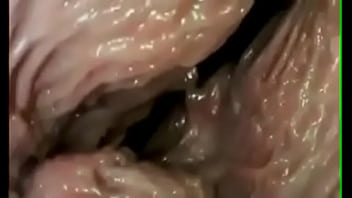 Preview 1 of Doctor Xxx Porn Sexx Video - Penetration Documentary