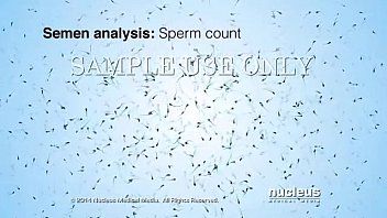 Preview 4 of Anglina X - Semen Analysis (Sperm Count)