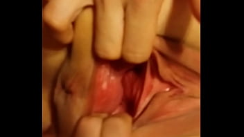 Preview 4 of Dr To Narcs - gape vid