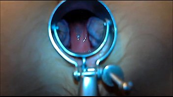 Preview 2 of Seyx5yier - speculum play 8 min