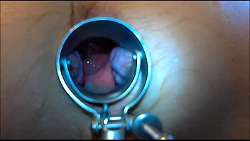 Preview 1 of Seyx5yier - speculum play 8 min