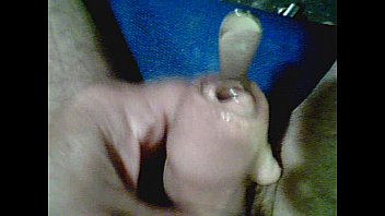 Preview 2 of Un Skript - burying a 24fr Van Buren in bladder