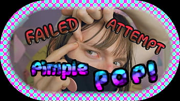 Preview 1 of Poroa Waths - 4k | FAILED ATTEMPT Pimple Pop! (teaser)