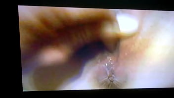 Preview 3 of Teen Sex Perfectgirltube - WP 20141020 23 39 59 Pro