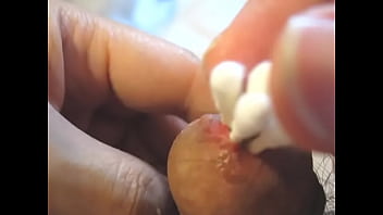 Preview 1 of Xnxx Twice - Insert the cotton swab into the urethra and spread peehole