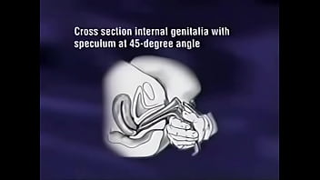 Preview 3 of Fatey Decoste - Female Vagina And Anus Check.