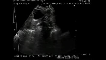 Preview 4 of Shave Massage - Gyno exam